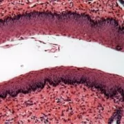 Filova-voedingsadvies-hond-slokdarm