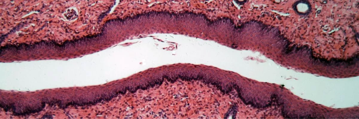 Filova-voedingsadvies-hond-slokdarm